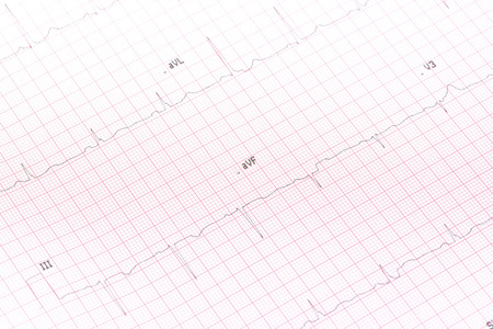 Electrocardiogram close-upの写真素材