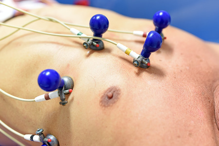 Electrocardiogramの写真素材