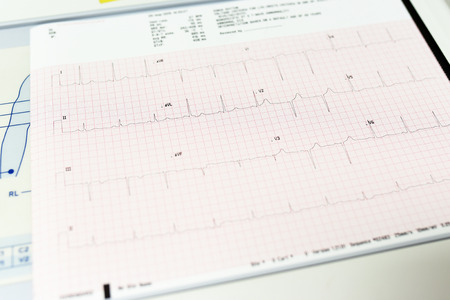Electrocardiogram close-up