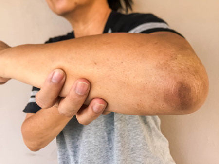 Old woman showing the rough elbow with white background.の写真素材