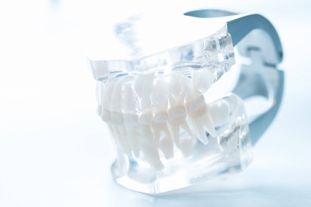 Dental model on white background. Selective focusの写真素材