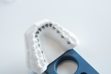Dental lower jaw bracket braces model on white. Selective focus.の写真素材