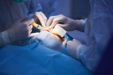 Plastic surgery of the eyelid in operating room, blepharoplasty.の写真素材