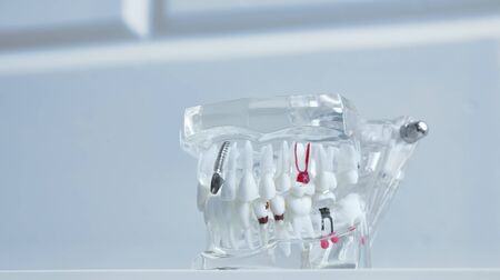 Close up of a Dental implant model.