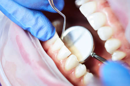 Close-up of woman opening his mouth wide during inspection of oral cavity. Shallow dof