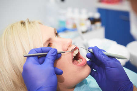 Dentist checking bracket at the braces on the female patient. Close-up. Real People.の写真素材