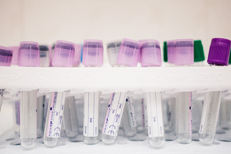 Fryazino, Russia: multi-colored tubes for blood, medical items, biomaterial collection, office...
