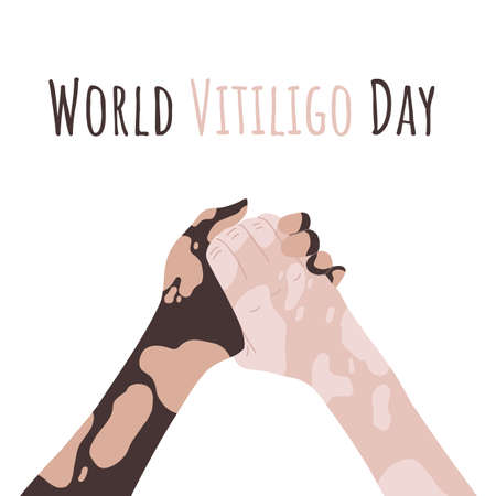 Hands with vitiligo disease. Support for people with skin pigmentation disorders. Different skin colors, different nationalities. Hand drawn illustration. Vector image on a white backgroundのイラスト素材