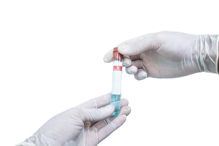 Hand holding glass tube with blue liquid inside, and old blank sticker for wordingの写真素材