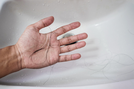 Close-up a man hand with loss hair, after taking shower, concepts of loosing hairの写真素材
