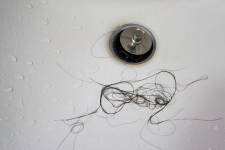 Loss hair on old dirty white washbasin
