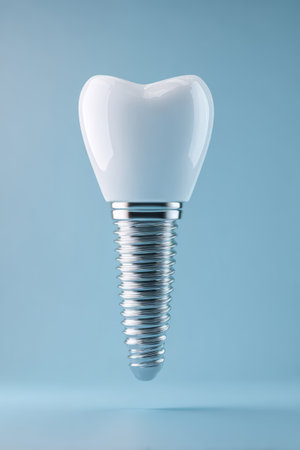 Model of dental implant with titanium screw and ceramic crown on blue background. Concept of tooth replacement, oral health and dental technologyの素材