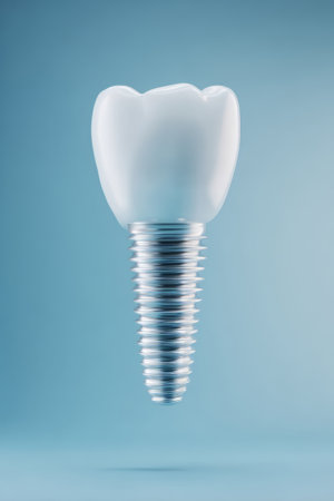 Model of dental implant with titanium screw and ceramic crown on blue background. Concept of tooth replacement, oral health and dental technologyの素材