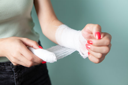 young brunette puts a bandage on her injured arm at homeの写真素材