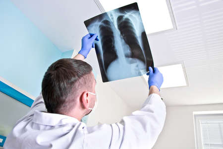 Doctor in the hospital looks at the x-ray of the lungs.の写真素材
