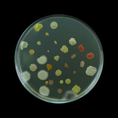Different bacterial colonies on a petri dish isolated on a black backgroundの写真素材
