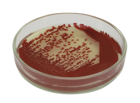 Red bacterial colonies on a petri dish isolated on a white backgroundの写真素材