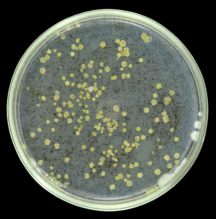 Oil oxidizing degrading bacteria from sea water grows on agar petri plate with small drops of crude oil as nutrient source. All dark spots and dots are petroleum drops. Isolation on a black background by pen tool.の写真素材