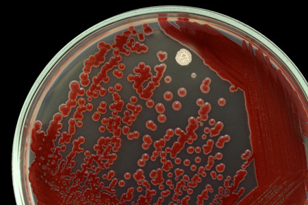Bacterial colonies on an agar surface macro photo. Nutrient agar media contains small light grains....
