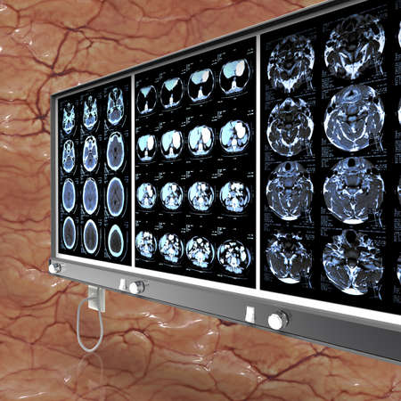 Closeup of a CT scan with brainの写真素材