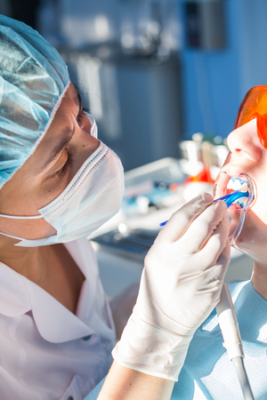 Teeth whitening procedureの写真素材