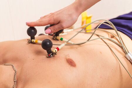 Medicine, health and heart check-up concept - Male patient having ECG electrocardiogram in hospitalの写真素材