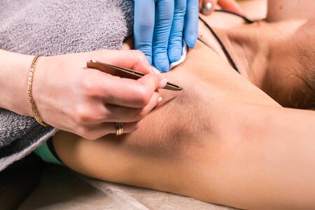 Close-up of removing armpit hair with tweezers. Female depilation. Cosmetology and beauty shop...