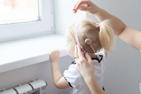 Cochlear implant on baby girls head. Hearing aid and deafness conceptの写真素材