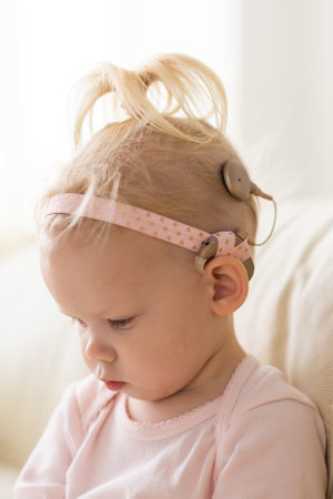 Baby with cochlear implants at home. Deafness and medical technology concept.の写真素材