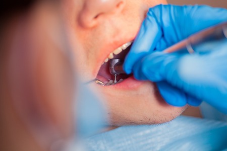 Dentist treatment a patient's teeth in the dentistの写真素材