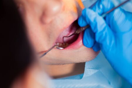 Dentist treatment a patient's teeth in the dentistの写真素材