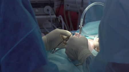 Operation using laparoscopic equipment. Surgeons team working with of patient in surgical operating room. Hospital.の写真素材