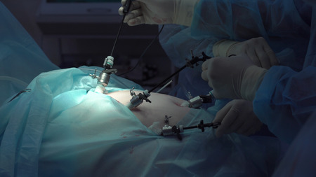 Operation using laparoscopic equipment. Surgeons team. Hospital.の写真素材