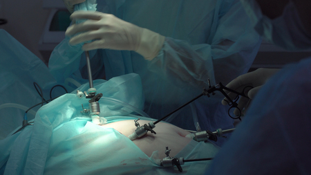 Operation using laparoscopic equipment. Surgeons team. Hospital.の写真素材