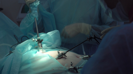 Operation using laparoscopic equipment. Surgeons team. Hospital.の写真素材