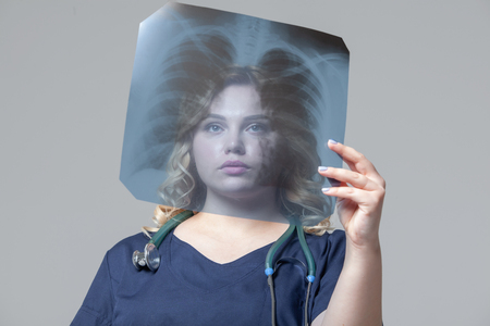 Young female doctor looking at the x-ray picture of lungsの写真素材
