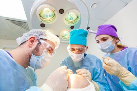 Baldness treatment. Hair transplant. Surgeons in the operating room carry out hair transplant surgery. Surgical technique that moves hair follicles from a part of the head.の写真素材