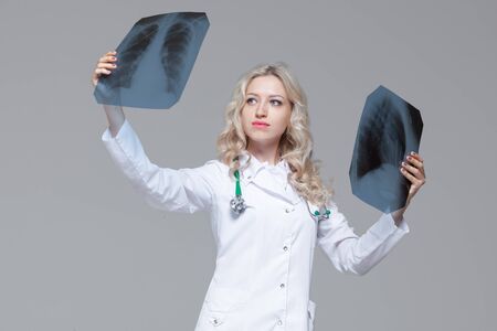Young female doctor looking at the x-ray picture of lungsの写真素材