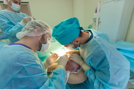 Baldness treatment. Hair transplant. Surgeons in the operating room carry out hair transplant surgery. Surgical technique that moves hair follicles from a part of the head.の写真素材