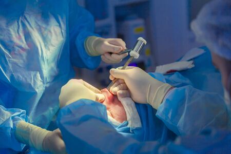 Surgeon and his assistant performing cosmetic surgery on nose in hospital operating room. Nose...