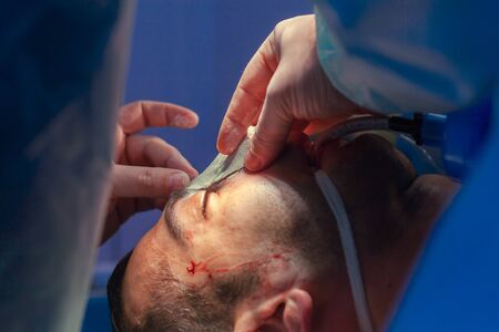 Surgeon and his assistant performing cosmetic surgery on nose in hospital operating room. Nose...