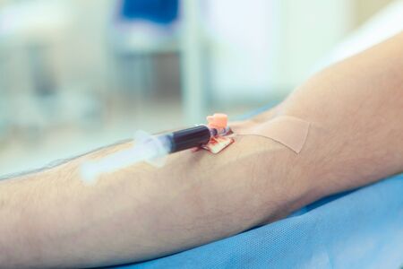 Preparation for surgery. Medical nurse with pink latex gloves inputs catheter to vein patient for drip of chemotherapy or another liquid medicine, jection of propofol to patient for iv anesthesia.の写真素材