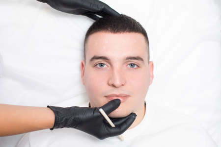 Close up of the face of a young man with marks on his forehead, and the hands of a cosmetologist in black medical gloves touching the guy face and holding a white cosmetic pencilの写真素材