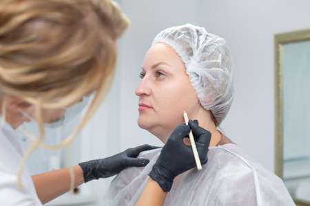 A female cosmetologist makes marks with a white cosmetic pencil on the face of a female patient before the upcoming cosmetic procedure for rejuvenation and getting rid of wrinklesの写真素材
