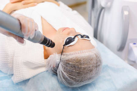 Photo of the face of a young girl wearing protective glasses during a carbon peeling procedure in a beauty salonの写真素材