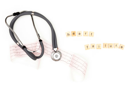Heart failure. Flatlay arrangement. Stethoscope with electrocardiogram sheet on isolated on white background. Place to copy paste.の写真素材