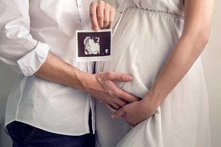 pregnant girl holding with their hands the belly and the husband keeps the hand in the ultrasound of their babyの写真素材