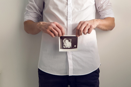 expectant father holding hands ultrasound of their childの写真素材