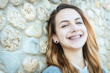 Beautiful smiling girl with retainer for teeth is resting on the outdoors.の写真素材