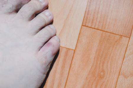 Broken leg. Detail of the leg in plaster of a man sitting.の写真素材